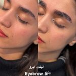 لیفت مژه و ابرو