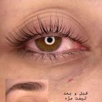 لیفت مژه و ابرو