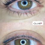 لیفت مژه و ابرو