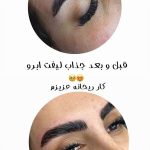 لیفت مژه و ابرو