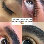 لیفت مژه و ابرو