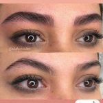 میکروبلیدینگ و فیبروز ابرو