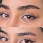 میکروبلیدینگ و فیبروز ابرو