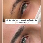 میکروبلیدینگ و فیبروز ابرو