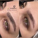 میکروبلیدینگ و فیبروز ابرو