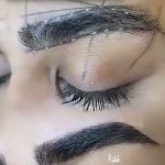 میکروبلیدینگ و فیبروز ابرو