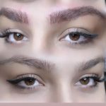 میکروبلیدینگ و فیبروز ابرو