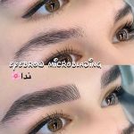 میکروبلیدینگ و فیبروز ابرو