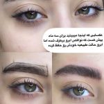 میکروبلیدینگ و فیبروز ابرو