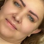 میکروبلیدینگ و فیبروز ابرو