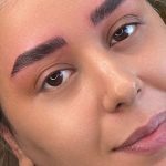 میکروبلیدینگ و فیبروز ابرو