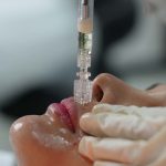 میکرونیدلینگ