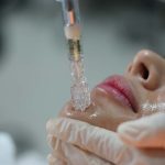 میکرونیدلینگ