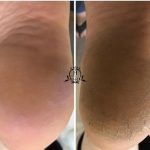 پدیکور و مانیکور