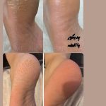 پدیکور و مانیکور