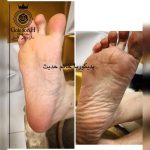 پدیکور و مانیکور