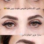 سالن زیبایی بارانا تهران
