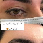اصلاح صورت و ابرو