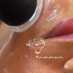 فیشیال صورت