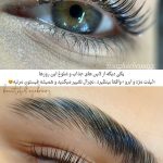 لیفت مژه و ابرو