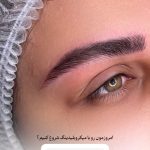 میکروبلیدینگ و فیبروز ابرو