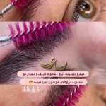 میکروبلیدینگ و فیبروز ابرو