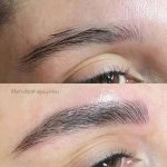 میکروبلیدینگ و فیبروز ابرو