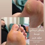 پدیکور و مانیکور