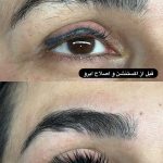 اصلاح صورت و ابرو