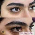 اصلاح صورت و ابرو