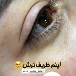 خط چشم و بن مژه دائم