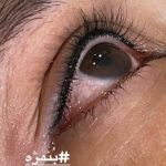 خط چشم و بن مژه دائم