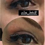 خط چشم و بن مژه دائم