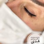 خط چشم و بن مژه دائم