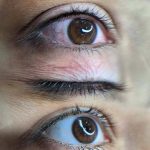 خط چشم و بن مژه دائم