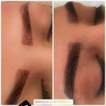 پاک کردن تتو