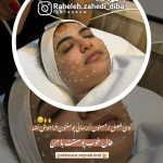 فیشیال صورت