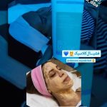 فیشیال صورت