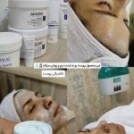 فیشیال صورت