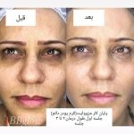 فیشیال صورت