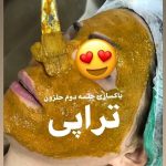 فیشیال صورت