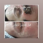 فیشیال صورت