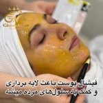 فیشیال صورت