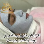 فیشیال صورت