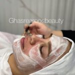 فیشیال صورت