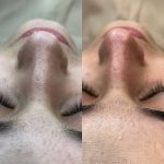 فیشیال صورت