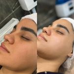 فیشیال صورت