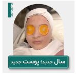 فیشیال صورت