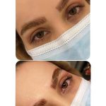 لیفت مژه و ابرو