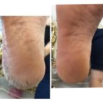 پدیکور و مانیکور